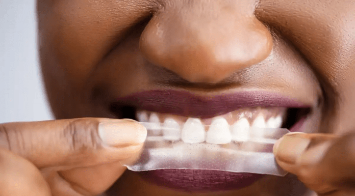 Are Residue Free Teeth Whitening Strips Safe For Health?