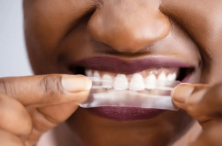 Are Residue Free Teeth Whitening Strips Safe For Health?